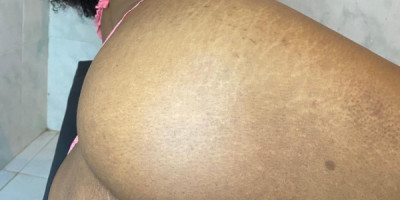 O meu atendimento é inesquecível sou carinhosa e faço um delicioso
